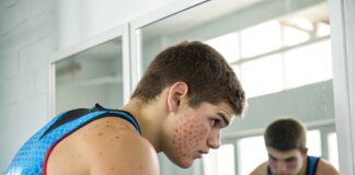 Uwaga na acne mechanica! Sprawdź, jak uniknąć trądziku mechanicznego Uwaga na acne mechanica! Sprawdź, jak uniknąć trądziku mechanicznego